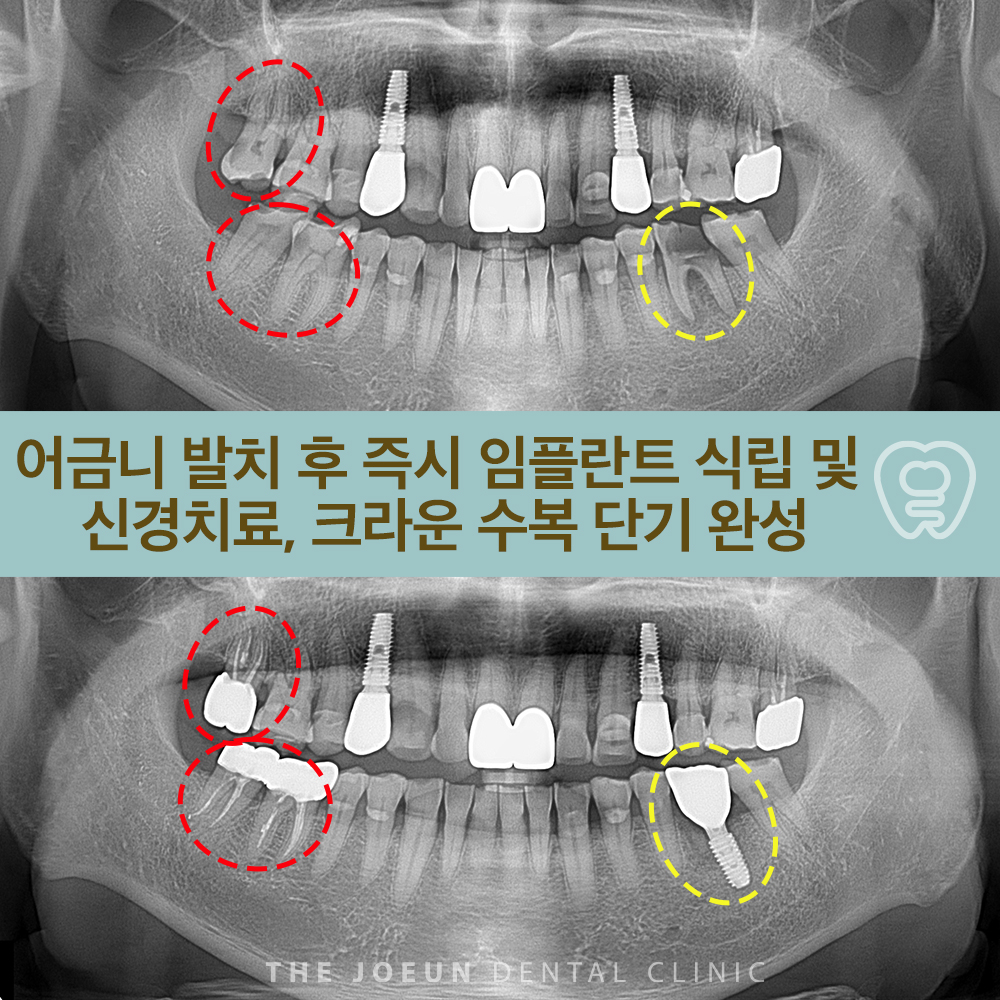 다사역치과추천 