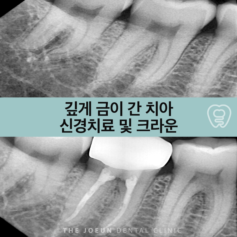 성서신경치료