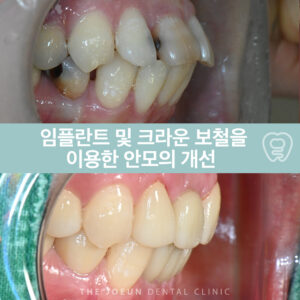 호산동치과