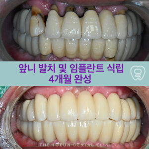 달서구치과