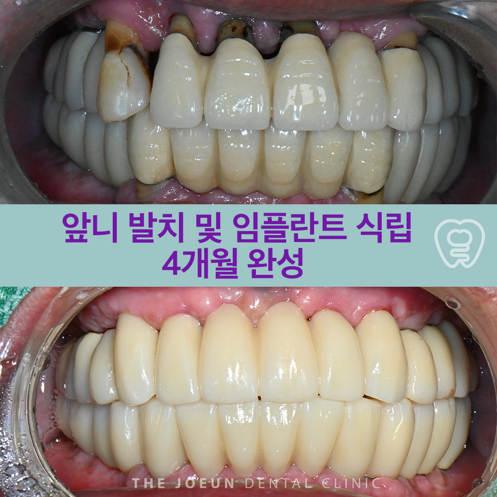 달서구치과 