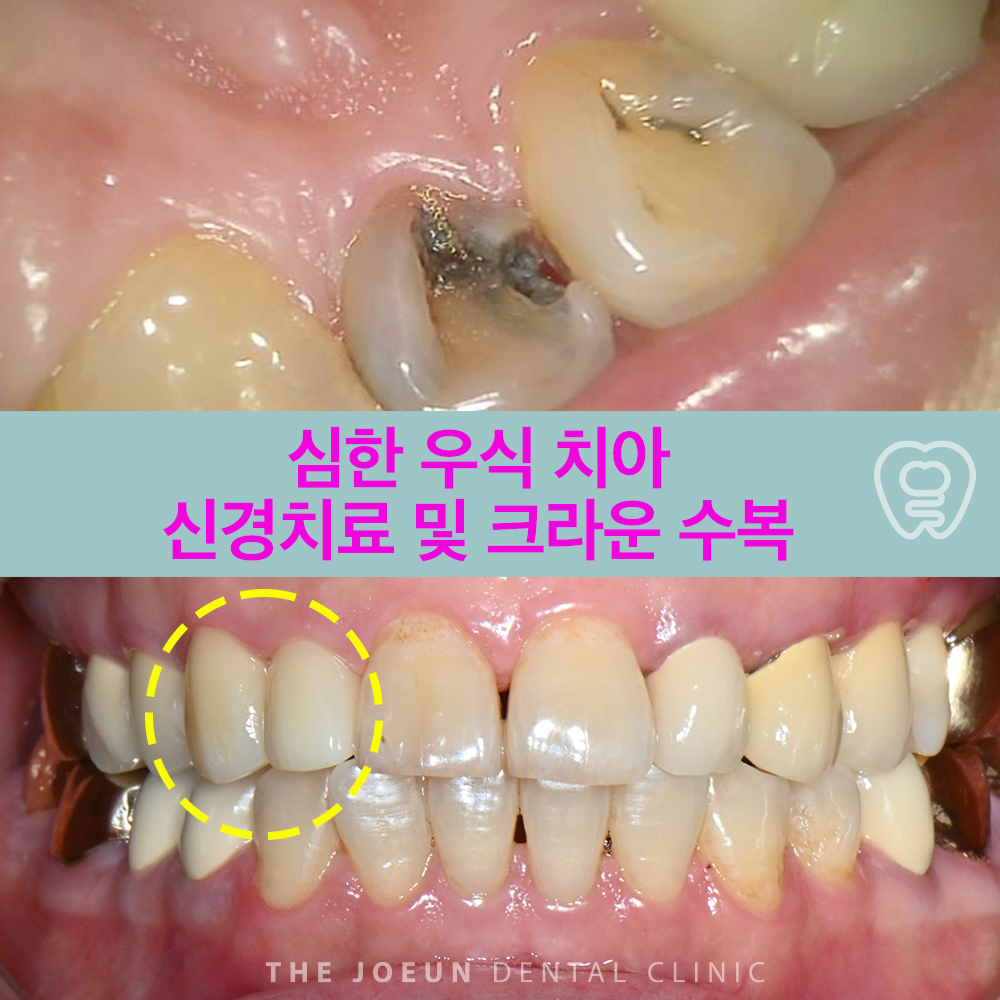 계명대치과