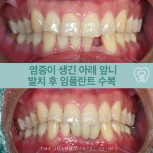 달서구치과