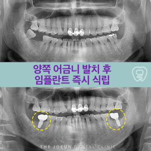 계명대치과