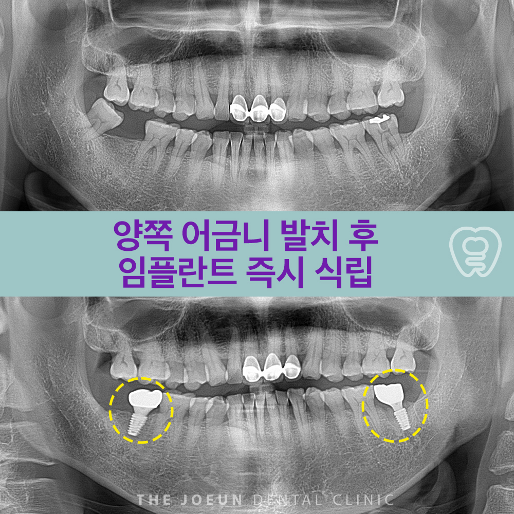 계명대치과