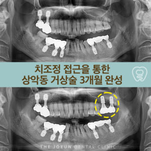 계명대치과